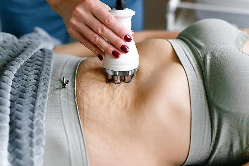 Körperformung und Fettreduktion